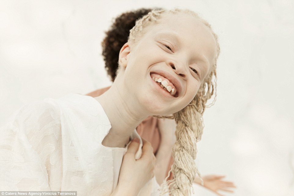 ECB  The girls worked with Vinicius on the shoot We feel albinism is  a