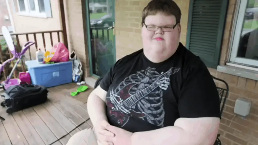 At Just 15 Years Old He Weighed 715 Pounds Just Wait Until You See Him Today