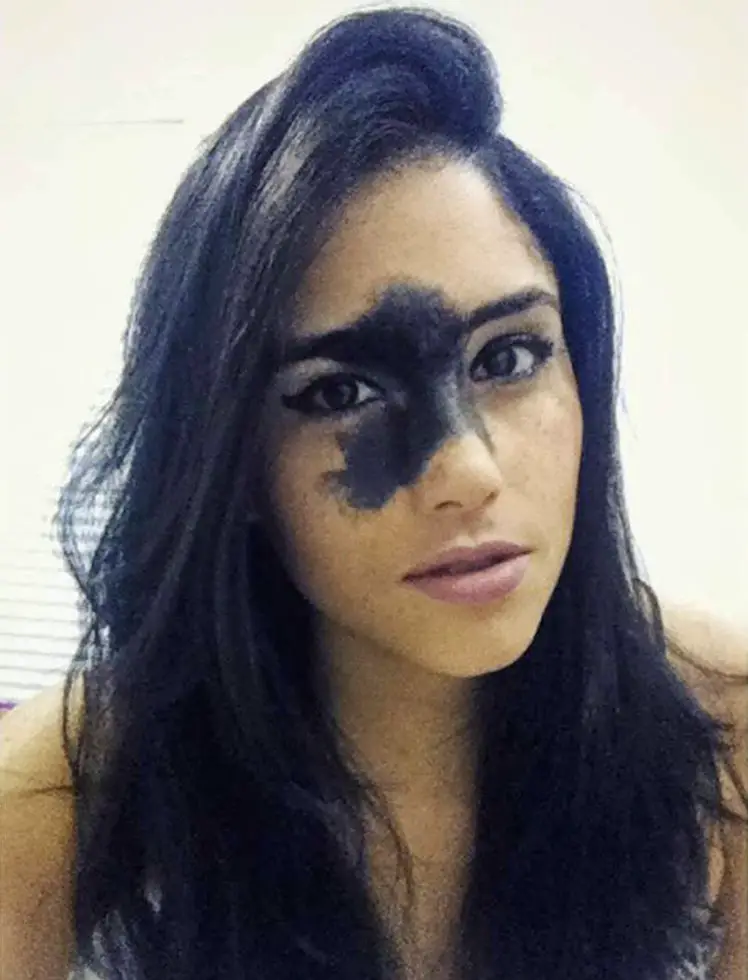 Woman Whose Birthmark Was Described As 'Ugly' Flaunts Her Natural Beauty In Empowering Modelling Shoot