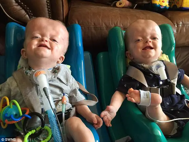 Selfless Grandmother Adopts Baby Twins Born With Rare Genetic Deformity