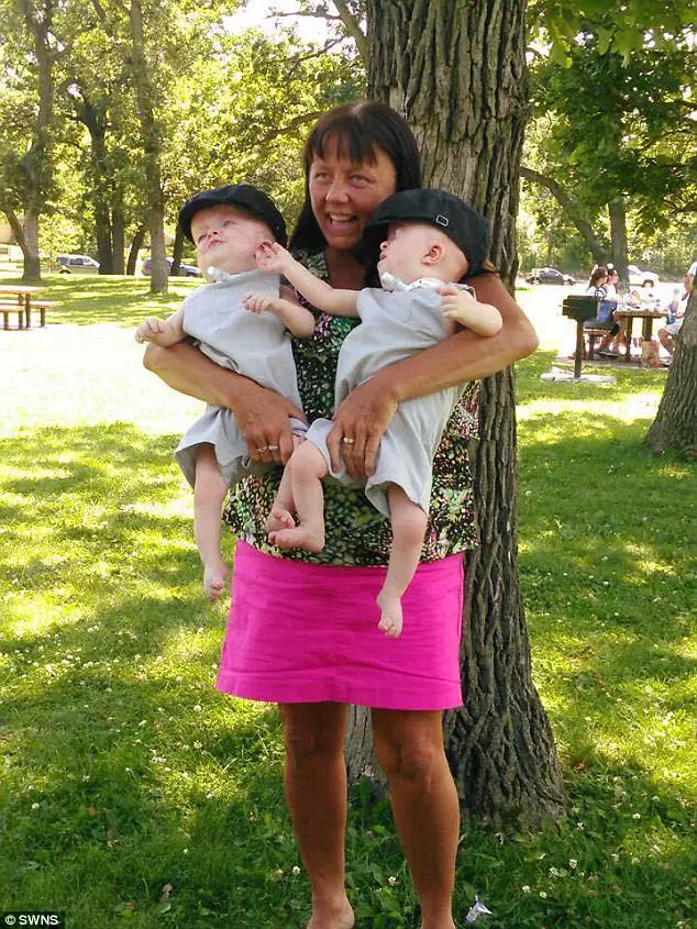 Selfless Grandmother Adopts Baby Twins Born With Rare Genetic Deformity