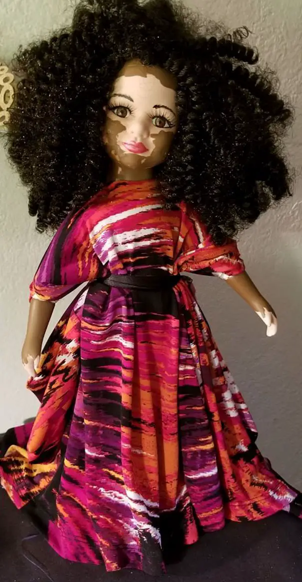 barbie vitiligo doll