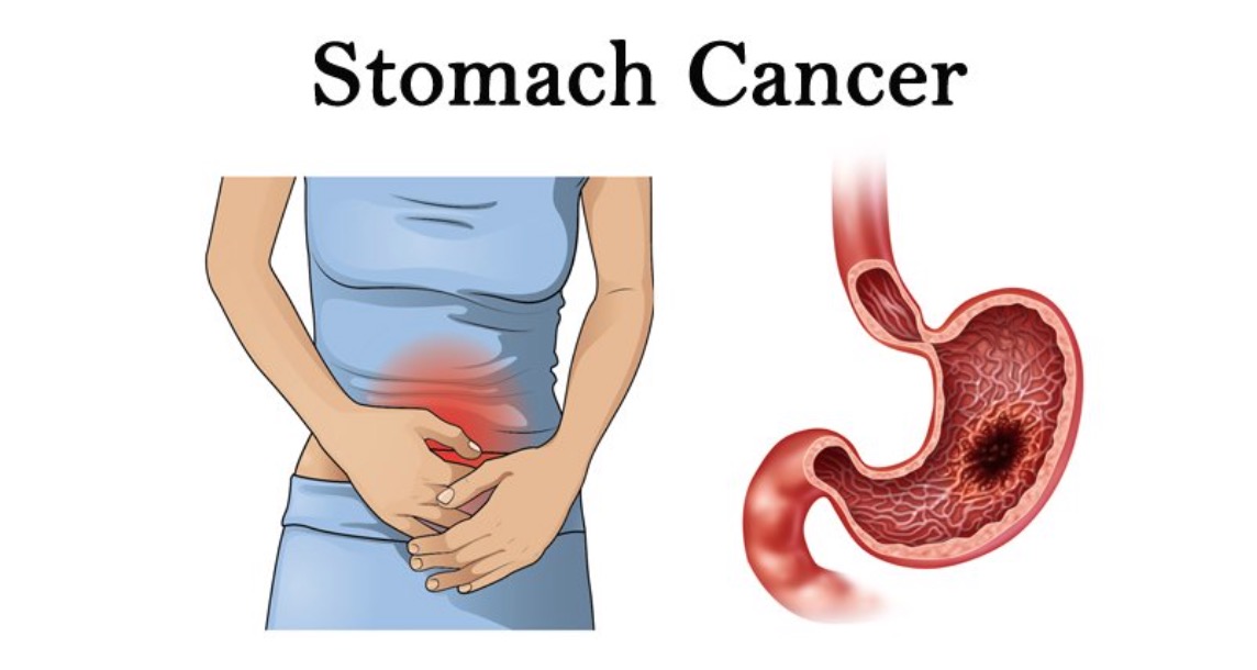 See stomach