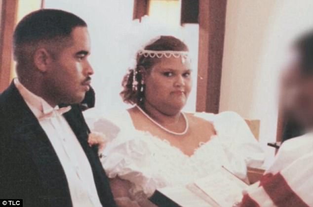 Bedridden Woman Who Weighed 750lb Sheds 274LBS After Being Unable To Visit Her Dying Husband In Hospital