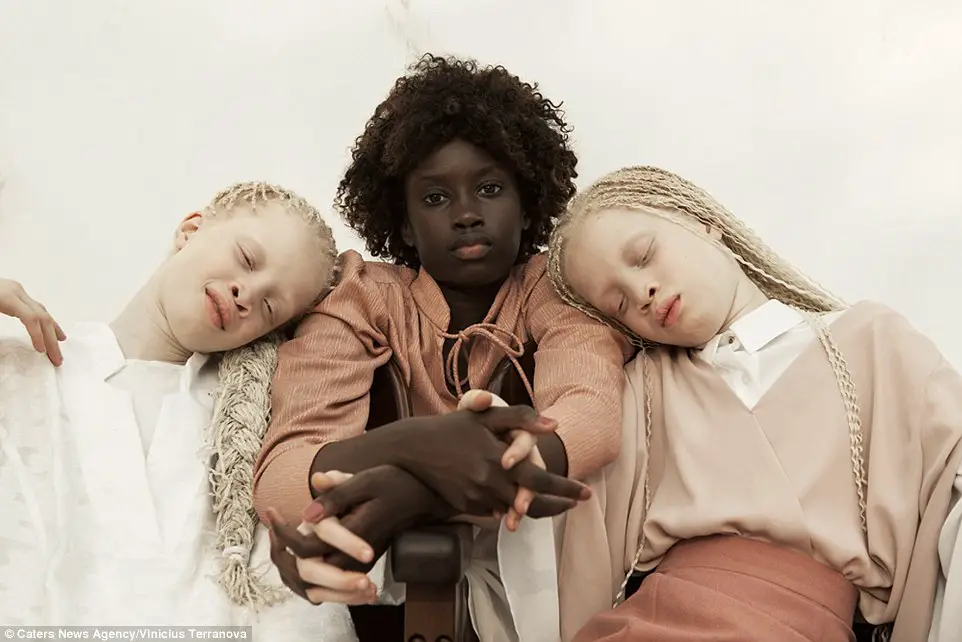 These Albino Twins From Brazil Are Causing A Stir In The Fashion Industry!