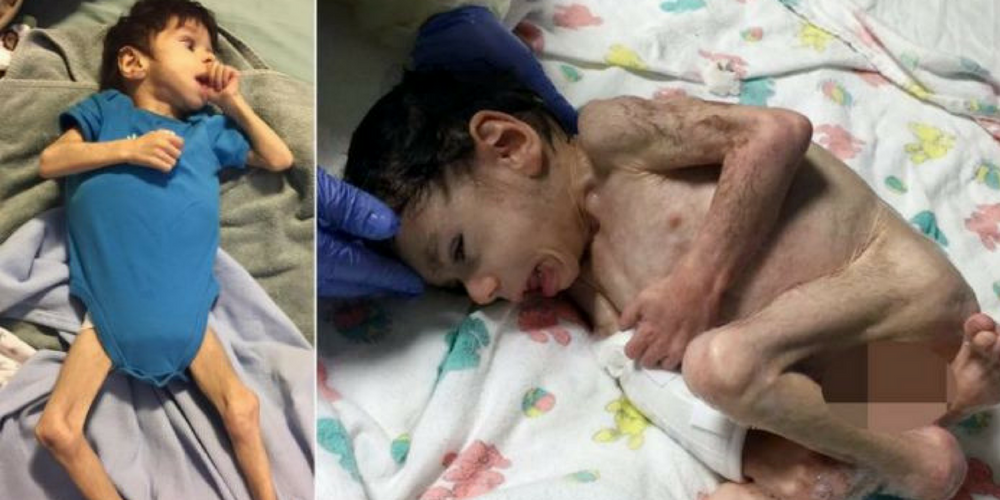 The Incredible Transformation Of An Eight-Year-Old Boy Who Almost Starved To Death In Bulgarian Orphanage
