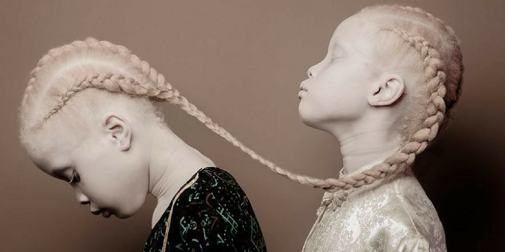 These Albino Twins From Brazil Are Causing A Stir In The Fashion Industry!