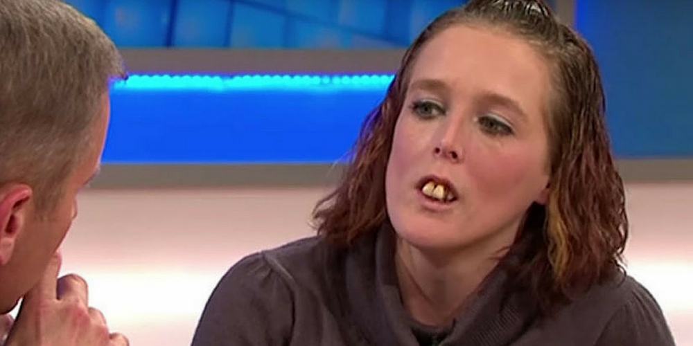 She Was Dragged Online For Her Bad Teeth. But Wait Until You See What She Looks Like Now!