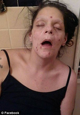 Mom Shares Disturbing Photos From The Grips Of Heroin Addiction Before Finally Getting Clean