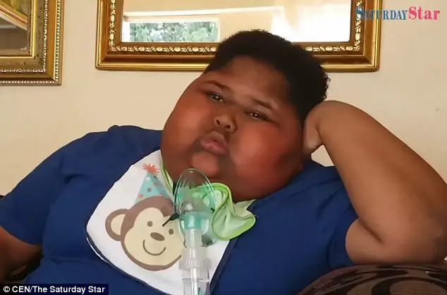 Ce garçon de 11 ans dépend exagérément de la nourriture... Affamé, il mange même les papiers toilettes (photos)
