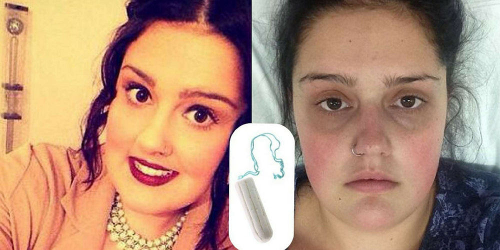 Student Almost Dies After Not Taking Her Tampon Out For Nine Days!