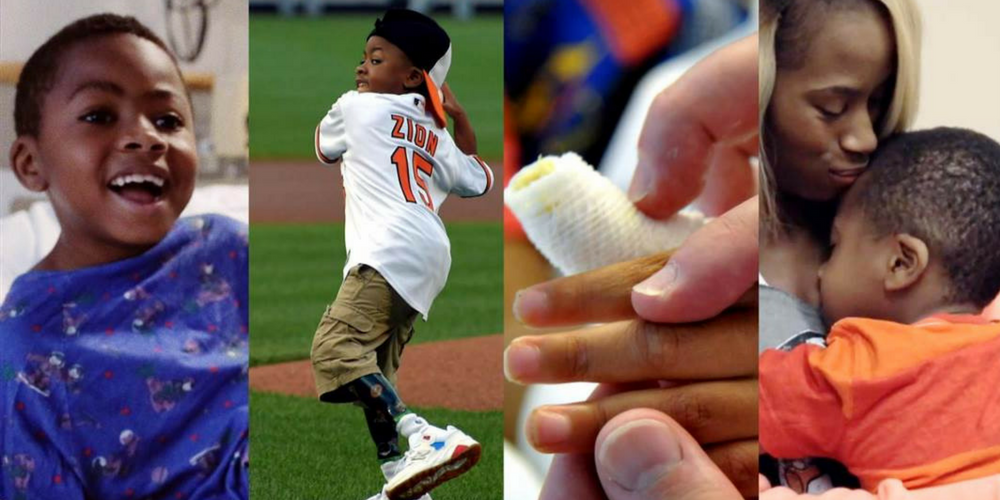 Zion Harvey: First Child To Undergo Double Hand Transplant Surgery Achieves Dream Of Swinging Baseball Bat