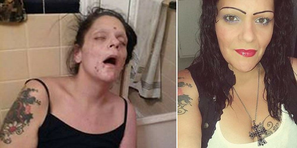 Mom Shares Disturbing Photos From The Grips Of Heroin Addiction Before Finally Getting Clean