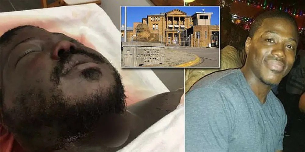 Family Release Gruesome Photos Of Inmate's Swollen Face After He Was