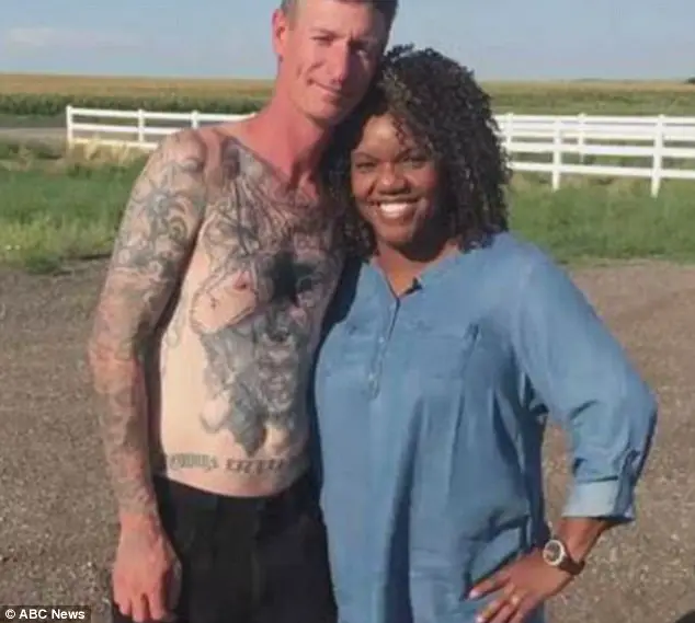 Former Neo-Nazi Has Swastika Tattoos Removed After Building Unlikely Friendship With African-American Probation Worker