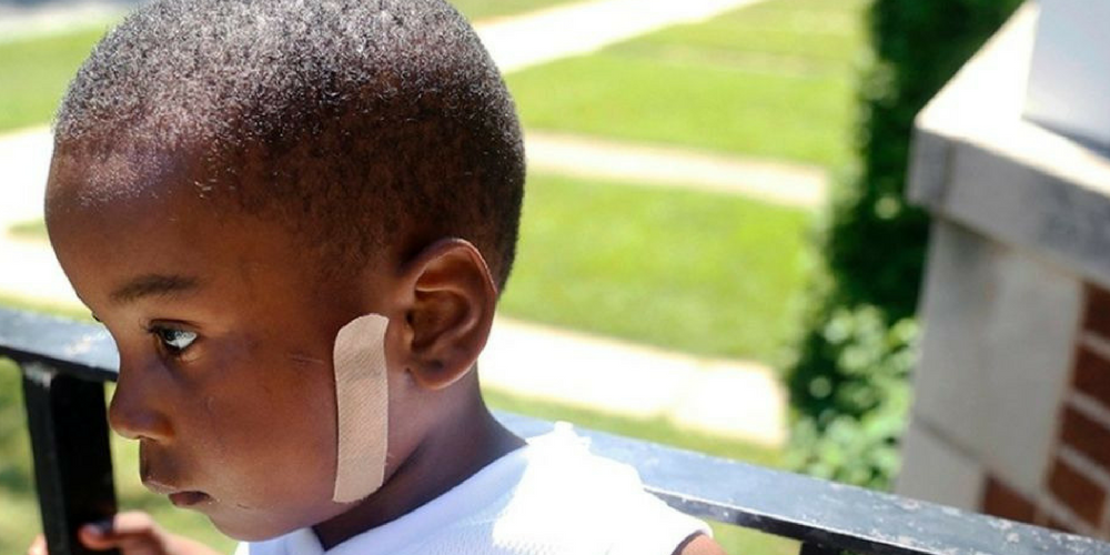 Five-Year-Old Chicago Boy Accidentally Shoots Himself – 18 Months After Stray Bullet Struck Him In The Jaw