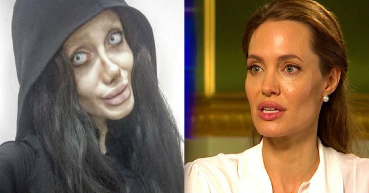 Teen ‘Undergoes 50 Surgeries’ In A Bid To Look Like Her Idol Angelina Jolie