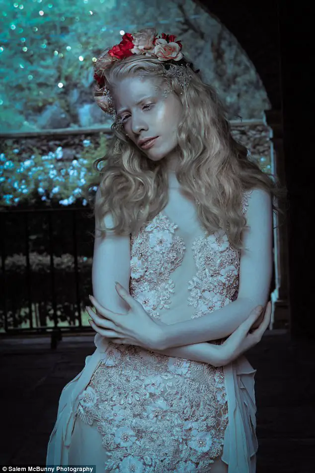 Albino Model Challenges Beauty Standards By Embracing Her Pale Skin And Silver Hair In A Series Of Stunning Photos