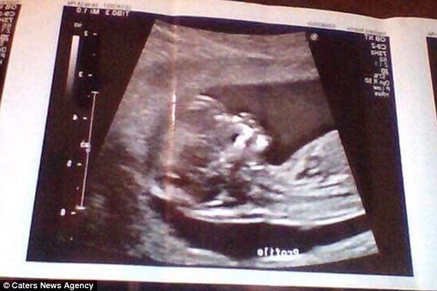 Mother-To-Be Shows Off Her Incredibly Flat Stomach Six MONTHS Into Her Pregnancy