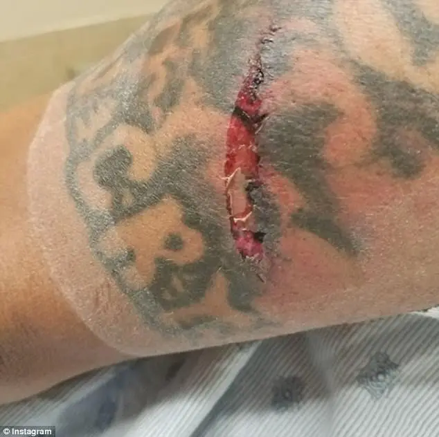 Audience Member Who Attacked Comedian Steve Brown With A Mic Stand Is Arrested And Charged With Aggravated Assault And Battery