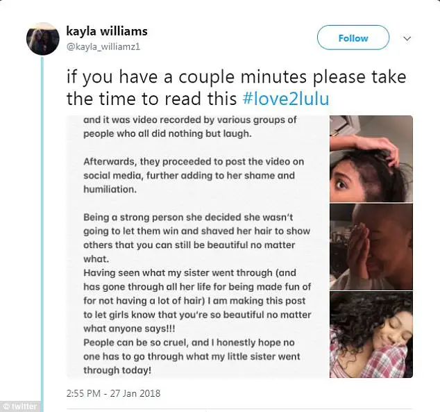 Shocking Moment High School Bullies Rip Off Wig Of Girl With Severe Scalp Condition