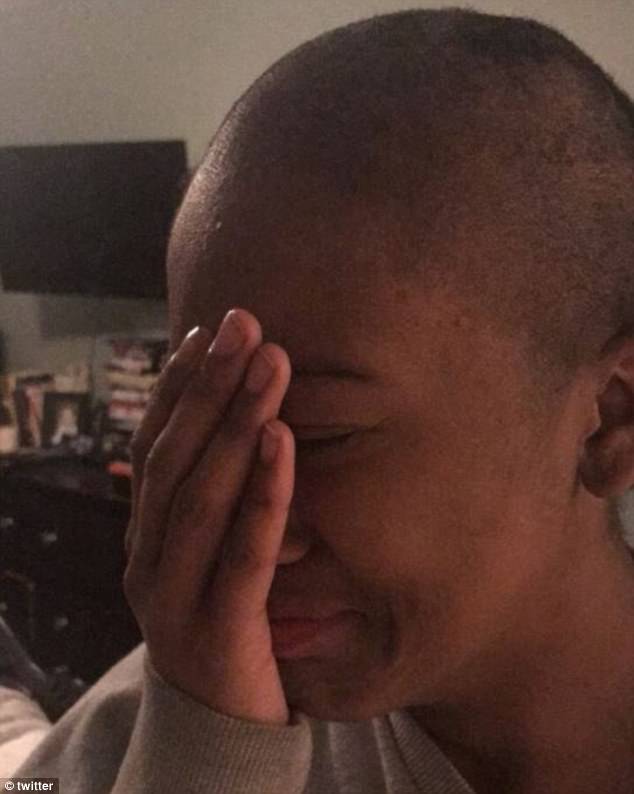 Shocking Moment High School Bullies Rip Off Wig Of Girl With Severe Scalp Condition