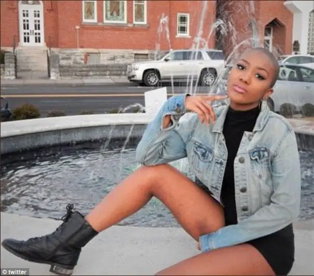 Shocking Moment High School Bullies Rip Off Wig Of Girl With Severe Scalp Condition