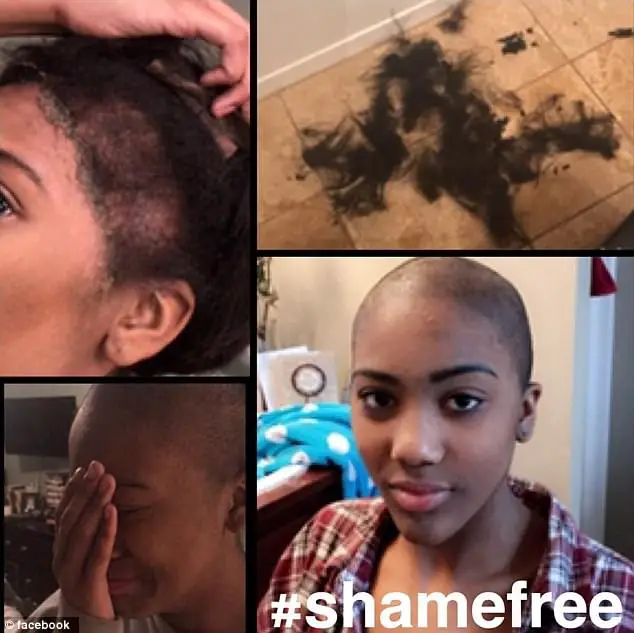 Shocking Moment High School Bullies Rip Off Wig Of Girl With Severe Scalp Condition