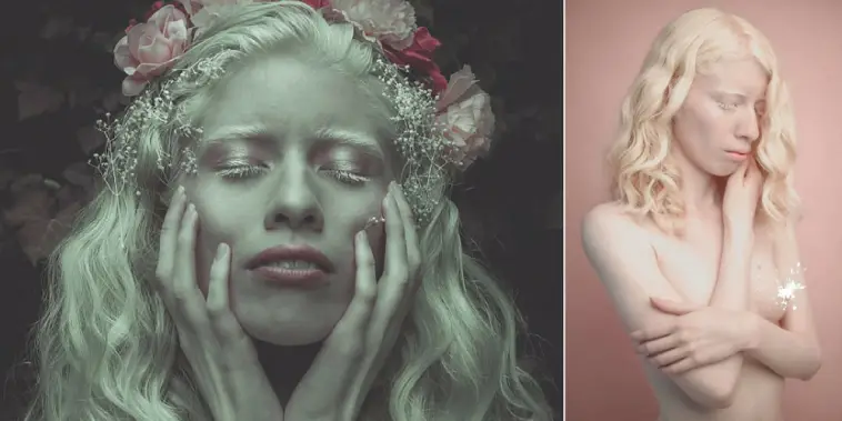 Albino Model Challenges Beauty Standards By Embracing Her Pale Skin And Silver Hair In A Series Of Stunning Photos