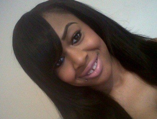 Acid Attack Survivor Forgives Best Friend Who Threw Corrosive Substance In Her Face