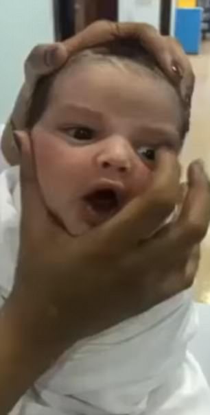 Nurses Spark Outrage As They Film Themselves Squashing A New-Born Baby's Face.