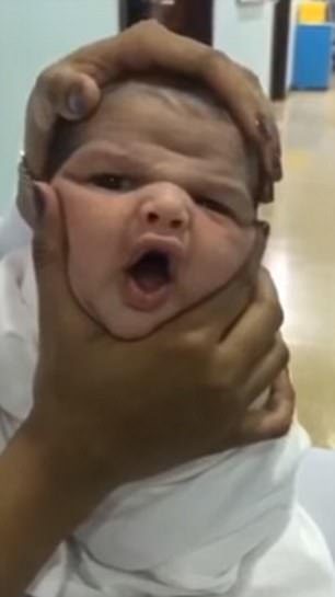 Nurses Spark Outrage As They Film Themselves Squashing A New-Born Baby's Face.