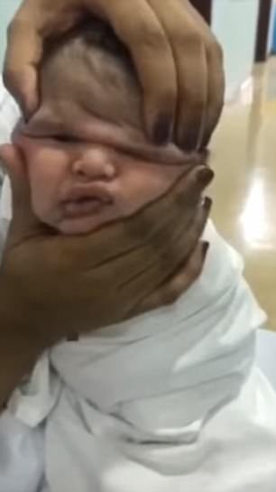 Nurses Spark Outrage As They Film Themselves Squashing A New-Born Baby's Face.