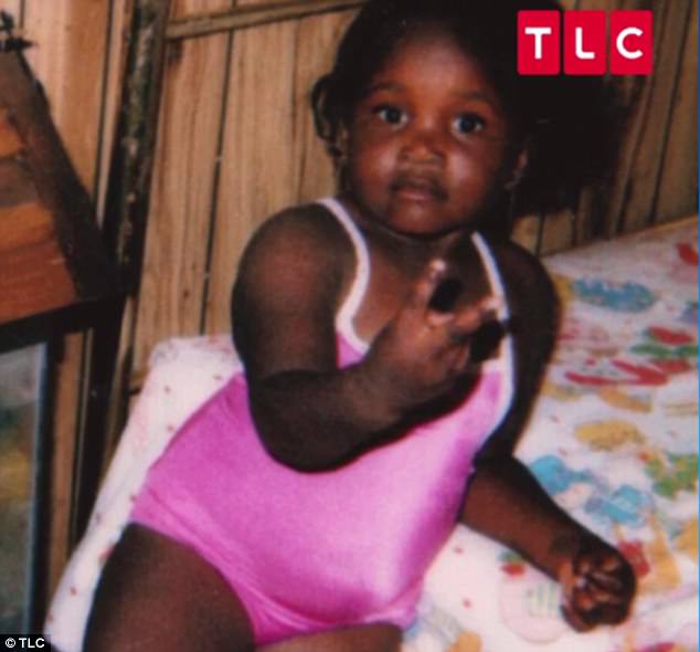 Bed-Bound 600lb Woman Reveals She Can't Stand Properly Because Of Massive Growths On Her Legs