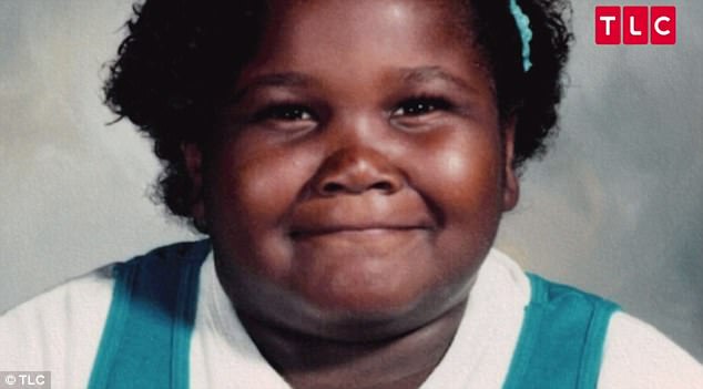 Bed-Bound 600lb Woman Reveals She Can't Stand Properly Because Of Massive Growths On Her Legs