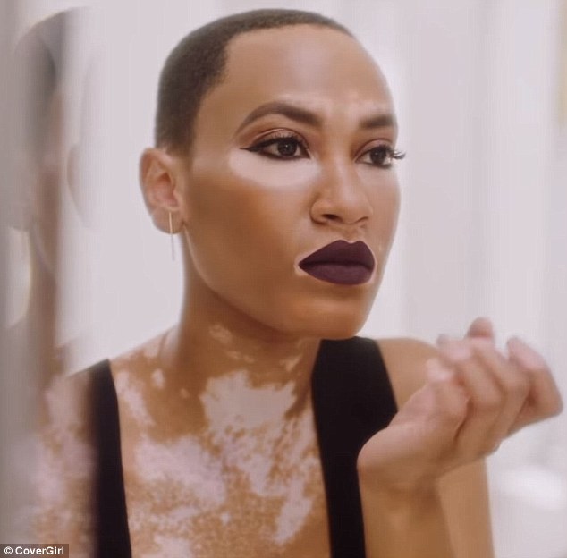 Model Becomes The First Person With Vitiligo To Star In A Campaign For CoverGirl