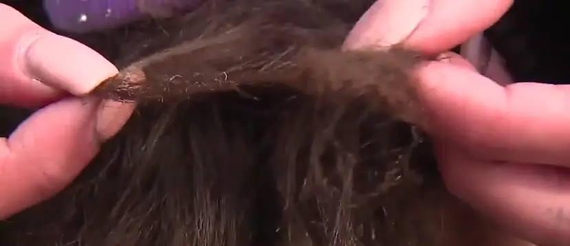 Mother Furious After Her Daughter's Hair Was Set on Fire by a Classmate and Teacher Did Nothing