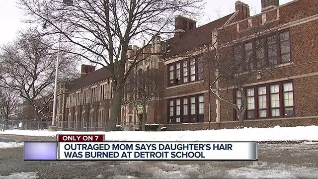 Mother Furious After Her Daughter's Hair Was Set on Fire by a Classmate and Teacher Did Nothing