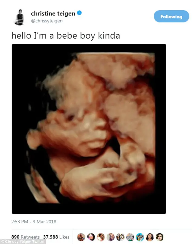 Chrissy Teigen Shares An Ultrasound Of Son She's Expecting With John Legend