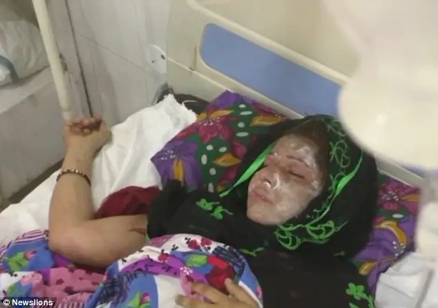 Indian Man 'Poured ACID On His Sleeping Wife' Because She Gave Birth To Two Daughters And He Wanted A Boy