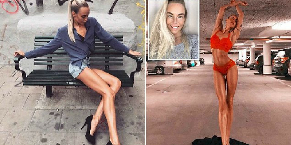 Swedish Model Boasts Astonishing 40-Inch Legs – But Reveals She Was Bullied At School Over Them