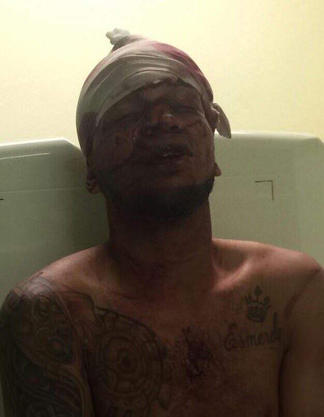 Boston Red Sox Star David 'Big Papi' Ortiz Shot At Nearly Point-Blank Range In Dominican Republic Bar