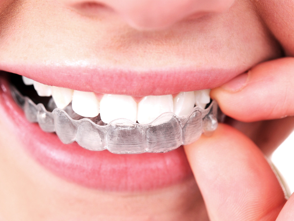 Aesthetic Dental Treatments for Adults: Invisalign, Orthodontics, and More
