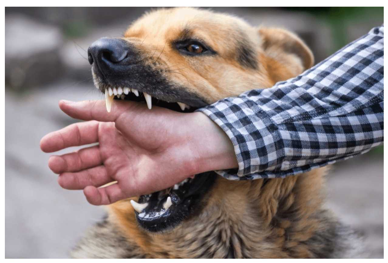 7 Things to Do If You’re Bitten By a Dog