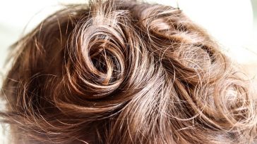 Best Vitamins for Hair Growth