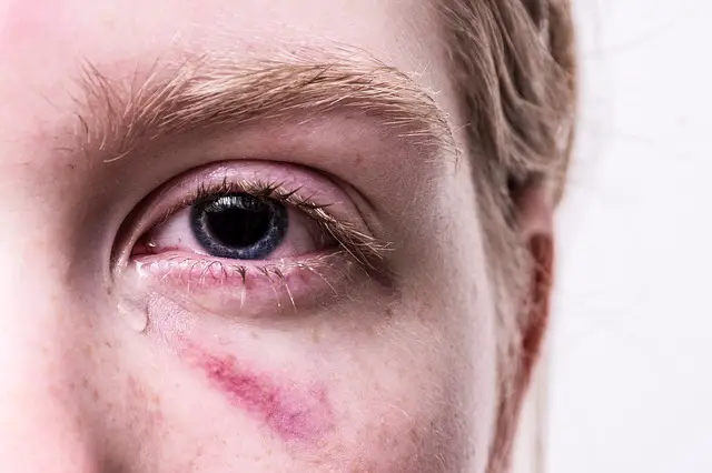 7 Common Eye Problems You Might Experience