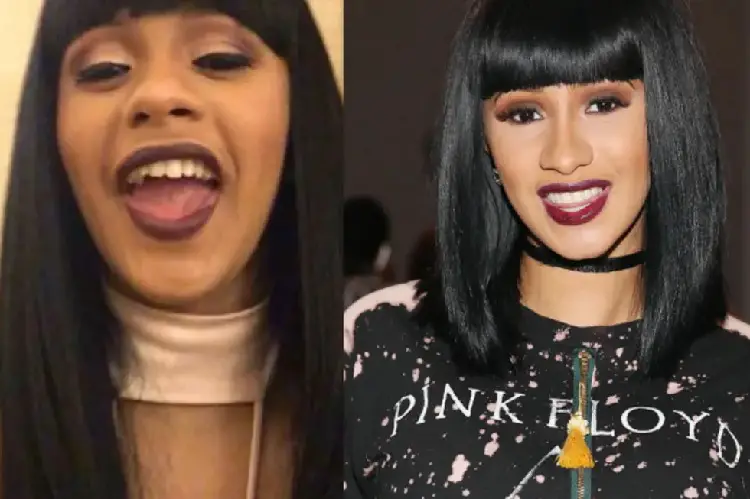 13 Celebrities Who Have Veneers