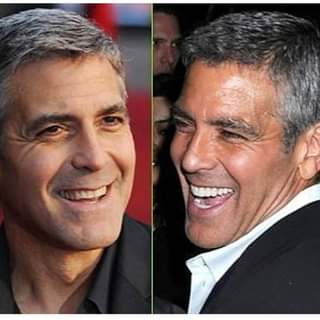 13 Celebrities Who Have Veneers