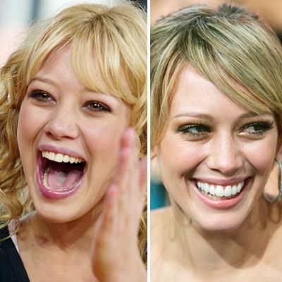 13 Celebrities Who Have Veneers