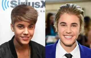 13 Celebrities Who Have Veneers